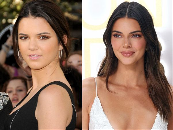 kendall jenner labios